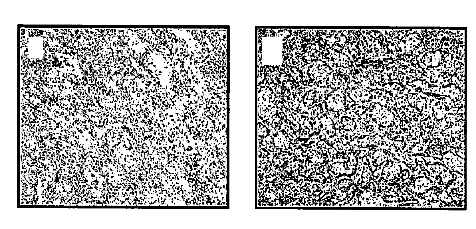 Method and pharmaceutical composition for preventing or treating diseases associated with inflammation