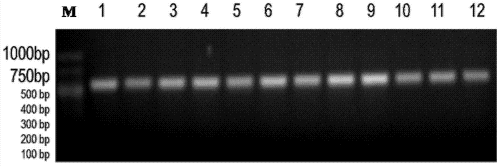 A kind of jellyfish jellyfish serine protease inhibitor and its coding gene and application