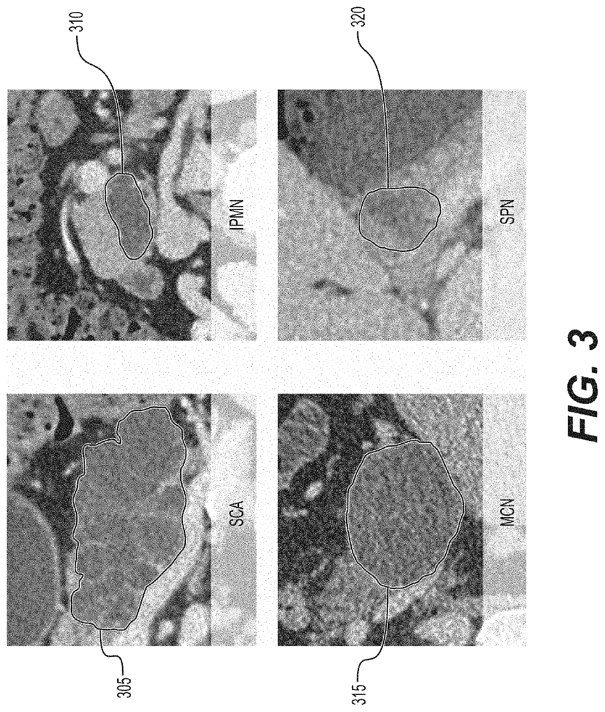 System, method, and computer-accessible medium for virtual pancreatography