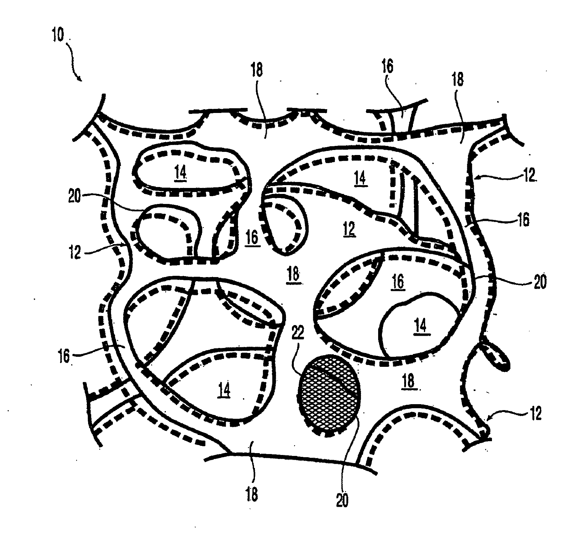 At least partially resorbable reticulated elastomeric matrix elements and methods of making same