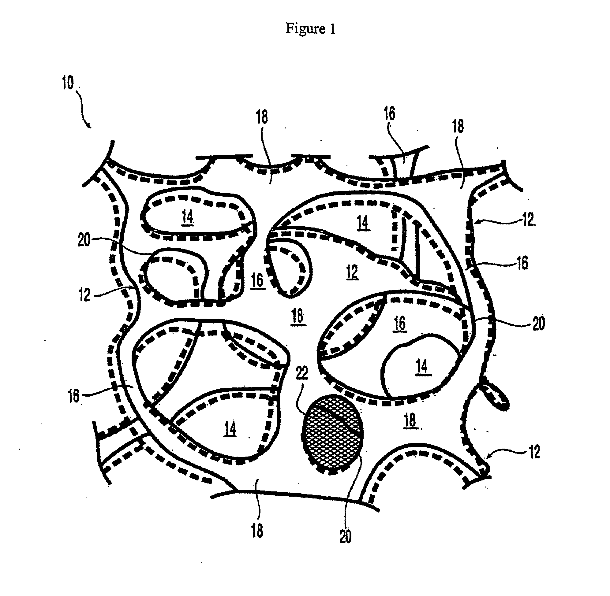 At least partially resorbable reticulated elastomeric matrix elements and methods of making same