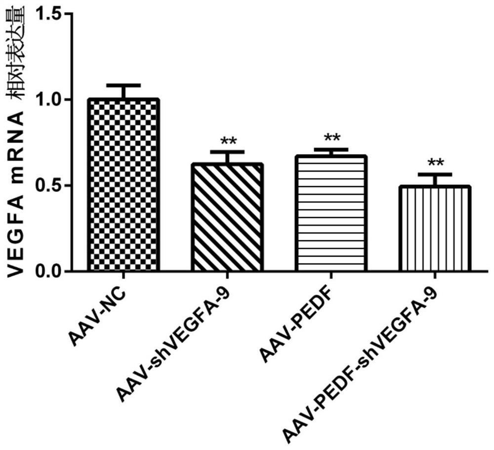 Gene medicine for preventing and treating neovascular eye diseases