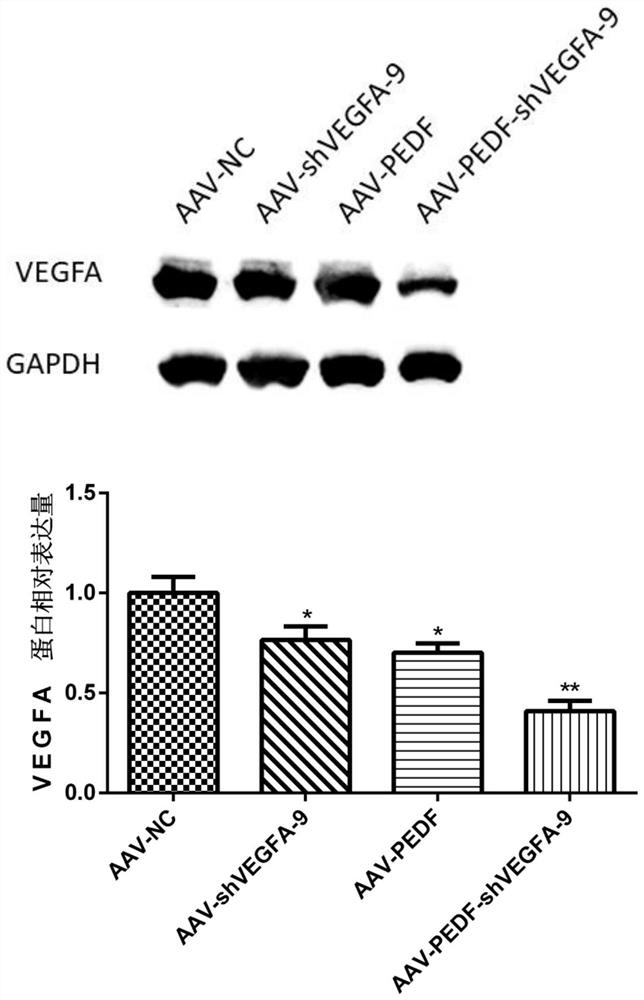 Gene medicine for preventing and treating neovascular eye diseases