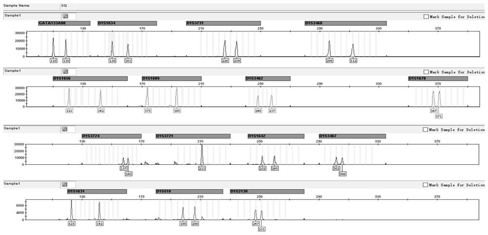 Composite amplification detection system for linked STR gene loci on human chromosomes I and II and application of composite amplification detection system