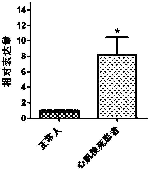 Myocardial infarction diagnosis marker-ING1 gene