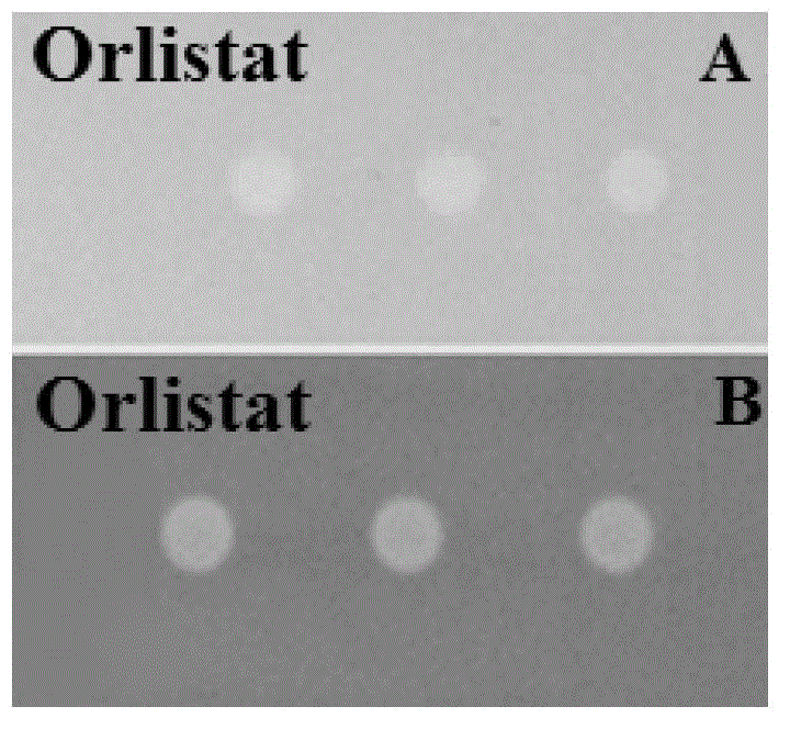 Method for screening lipase inhibitor