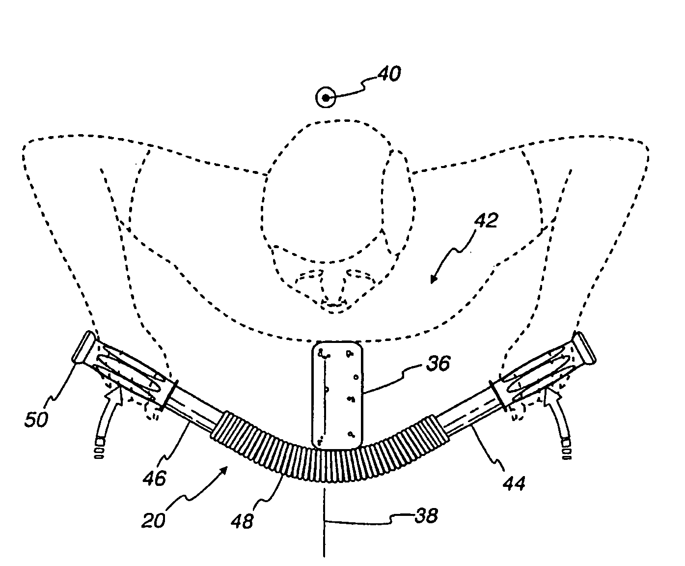 Exercise device and methods