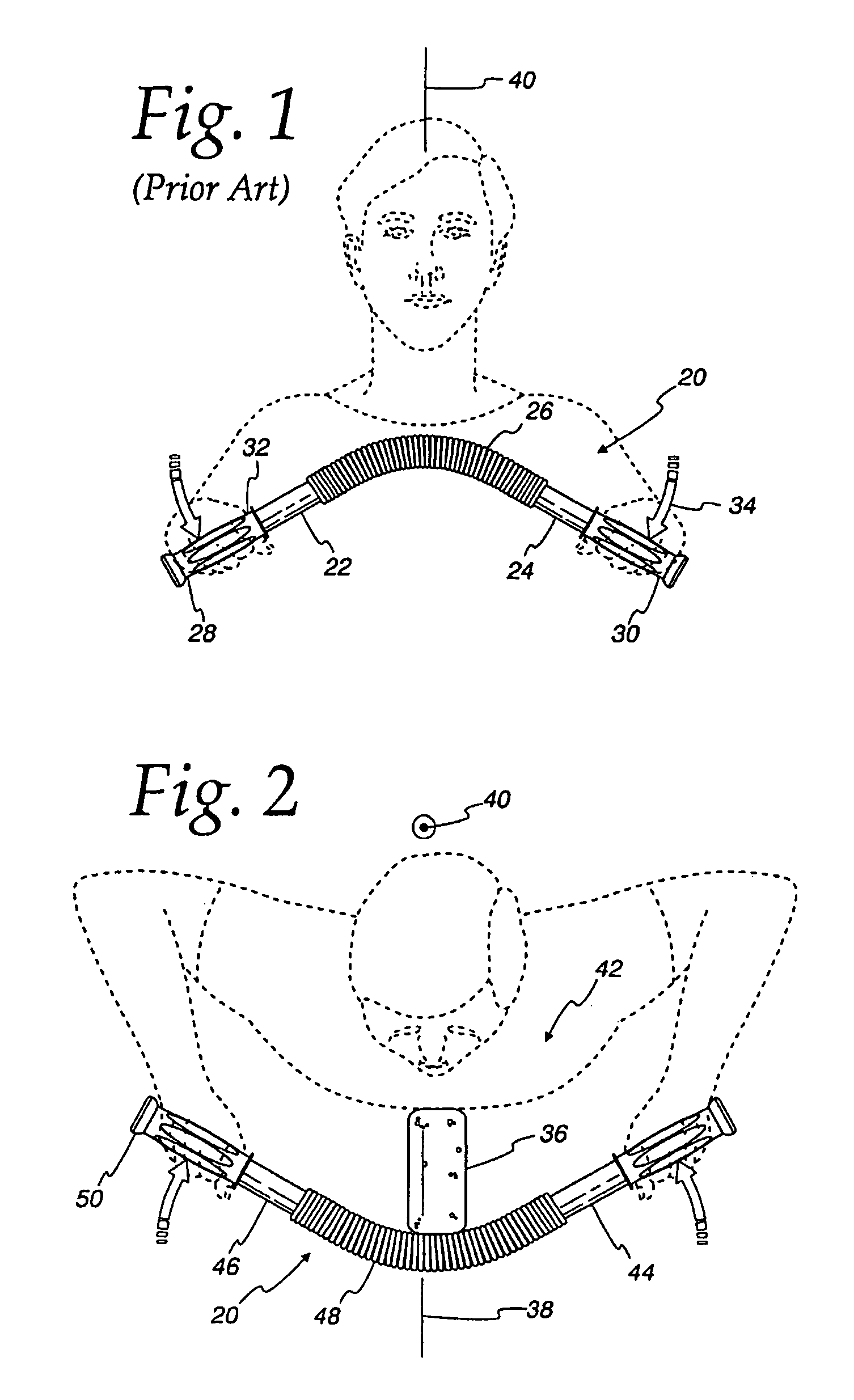 Exercise device and methods