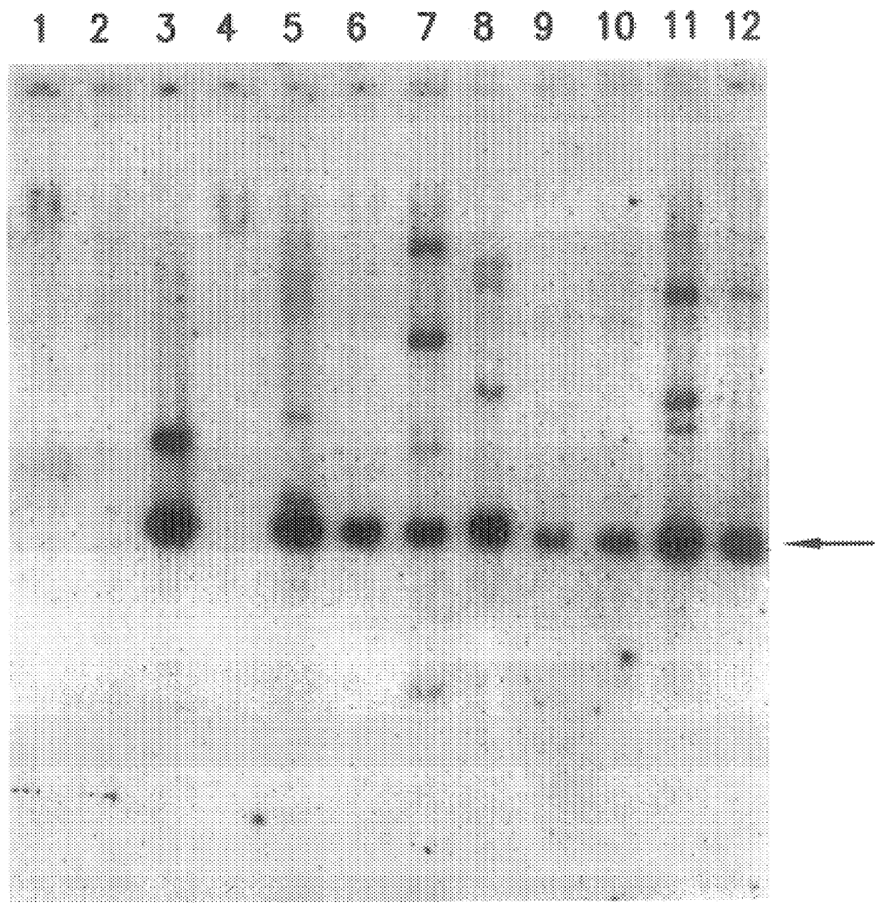 Vectors for expression of globin genes