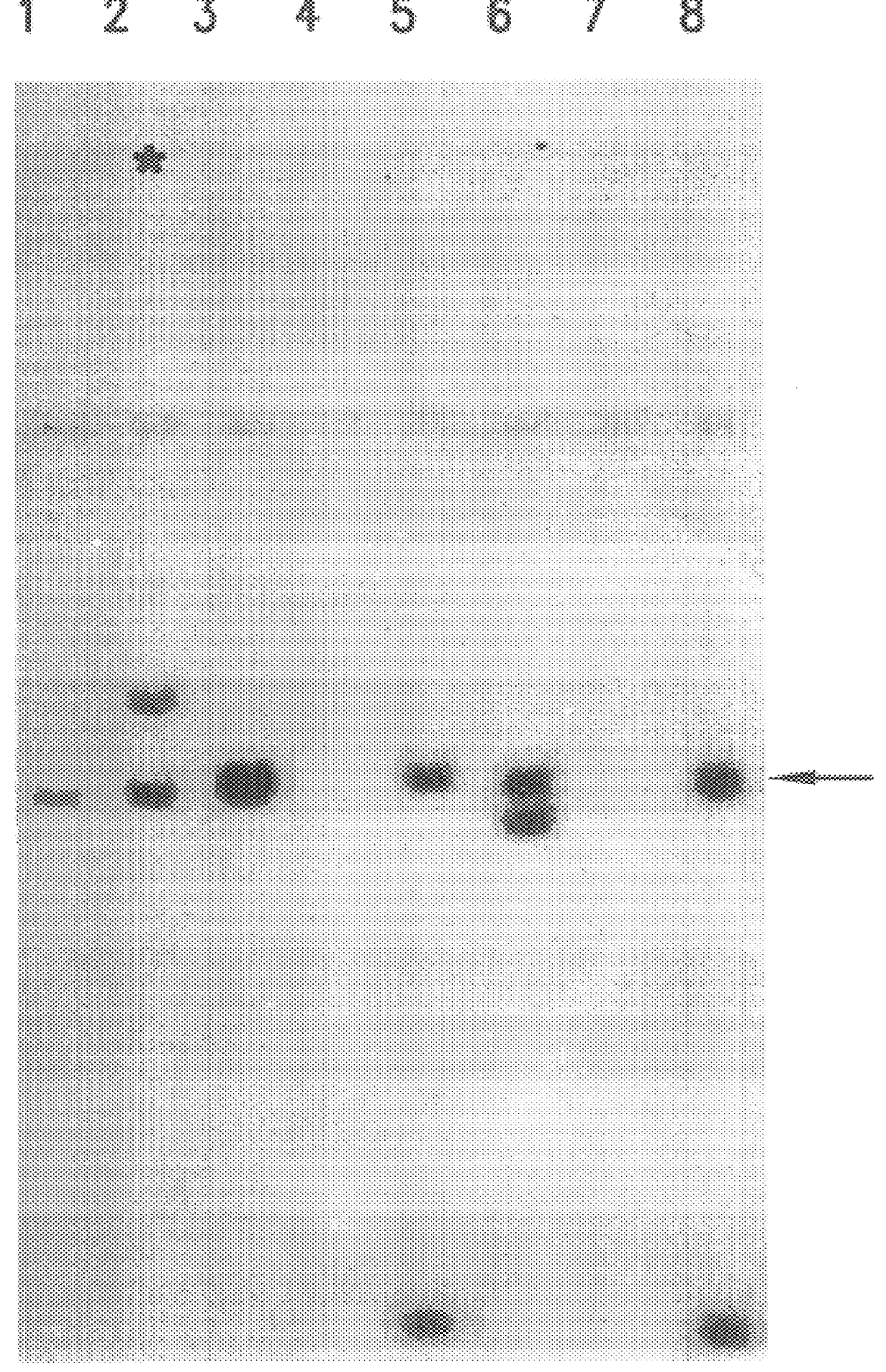 Vectors for expression of globin genes