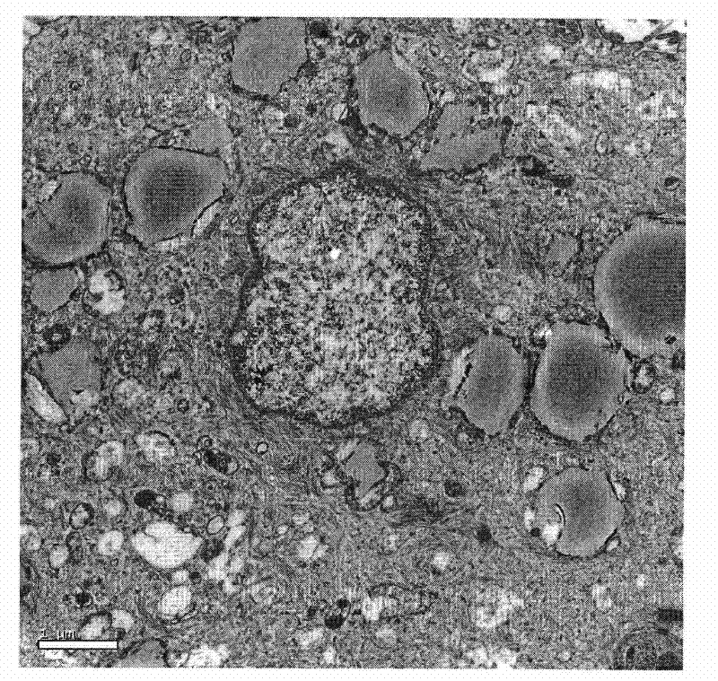 Method for extracting unsaturated fatty acid composition from humen amniotic epithelial cells, and application thereof