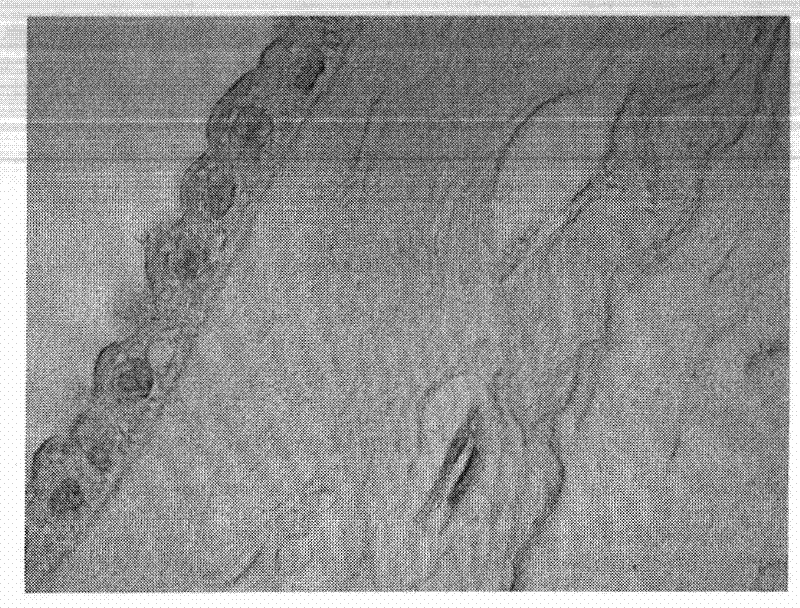 Method for extracting unsaturated fatty acid composition from humen amniotic epithelial cells, and application thereof