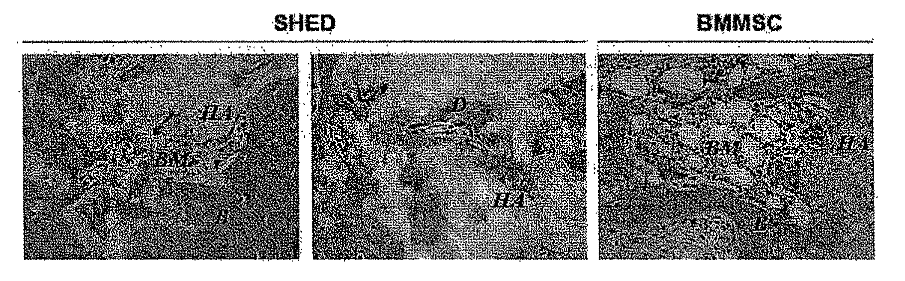 Stem Cell Modified Animal Model for Aging-Related Degenerations, Stem Cell Based Methods and Compositions for Extending Lifespan and Treating SLE-Like Autoimmune Diseases