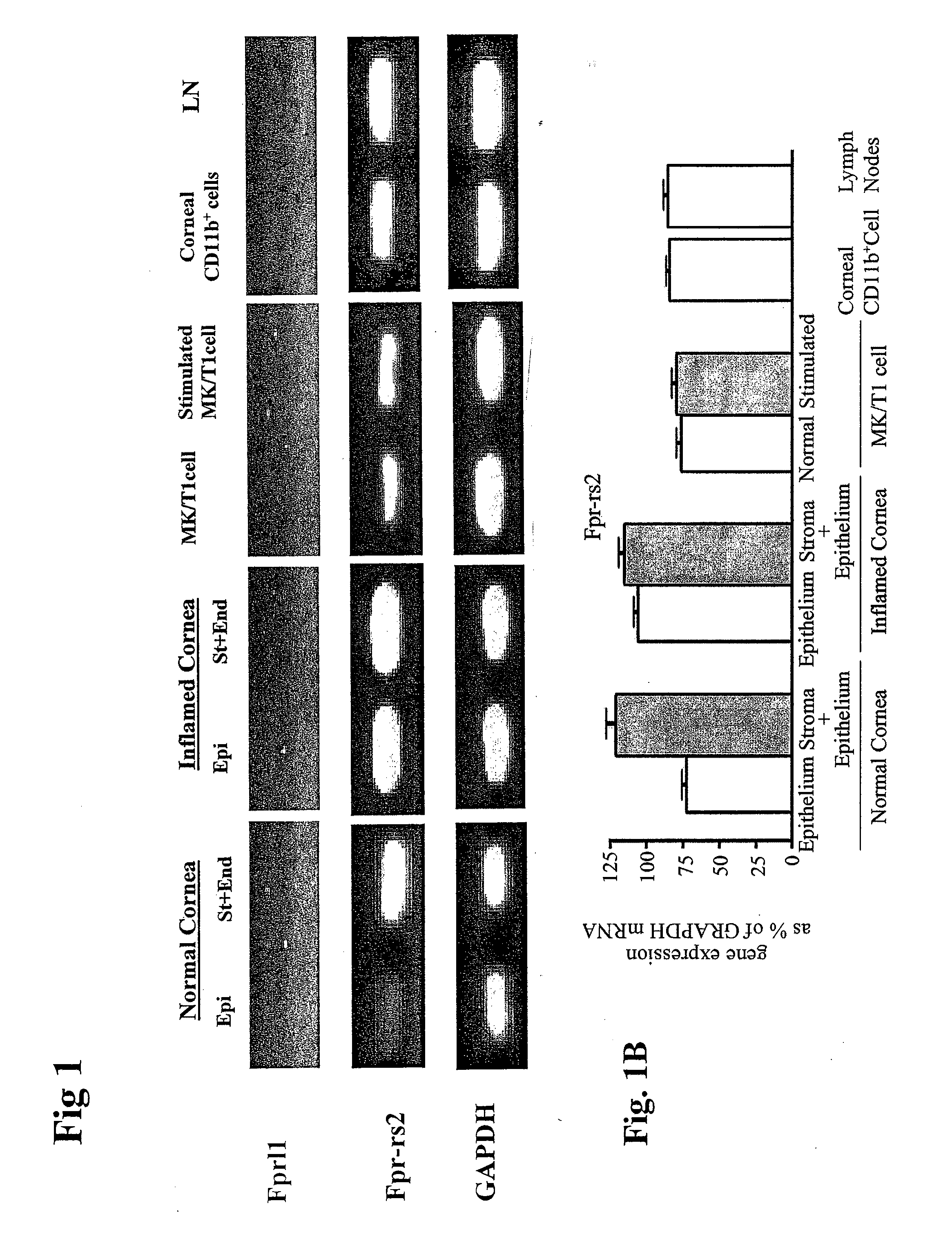 Use of novel lipid mediators to inhibit angiogenesis