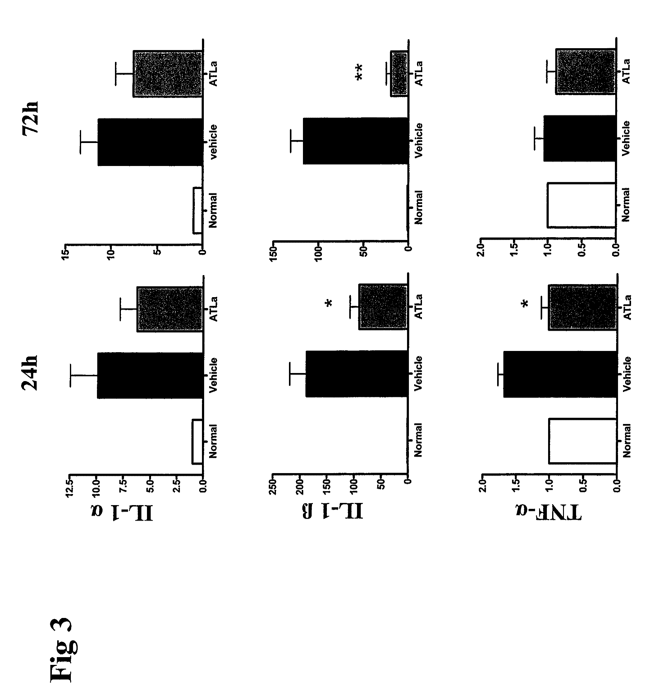 Use of novel lipid mediators to inhibit angiogenesis