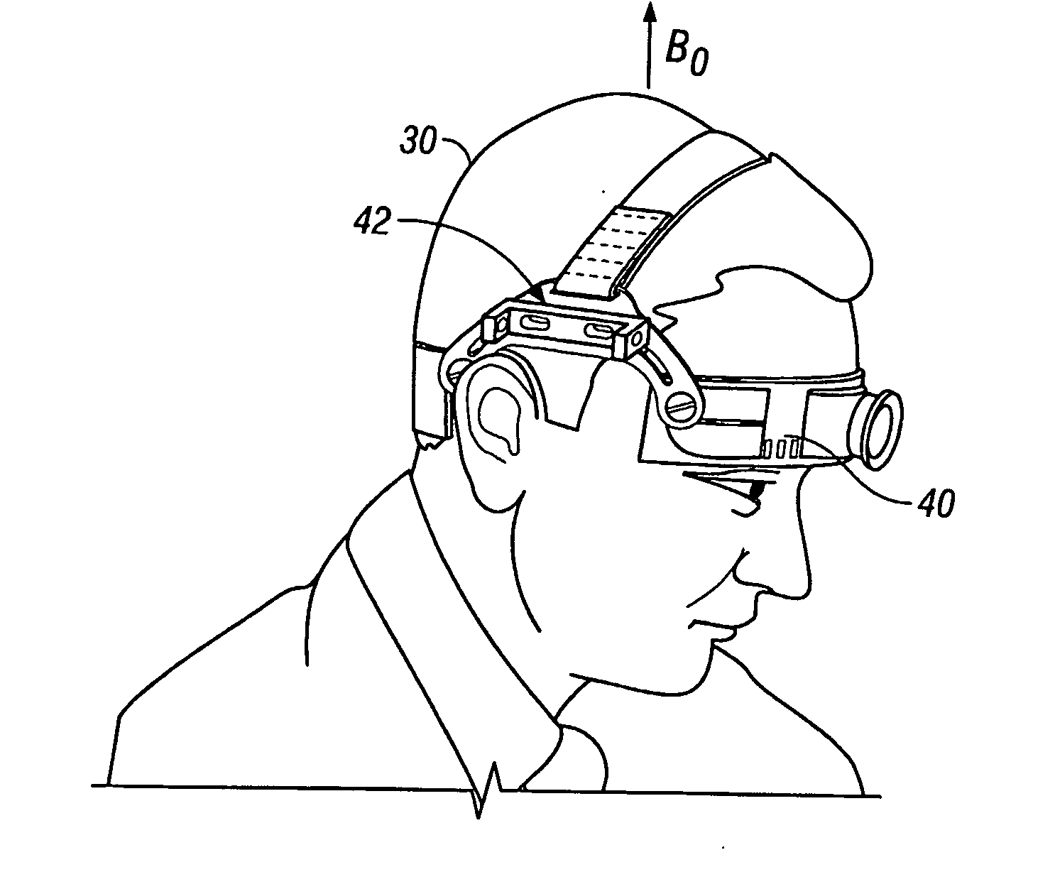 In vivo brain elasticity measurement by magnetic resonance elastography with vibrator coil