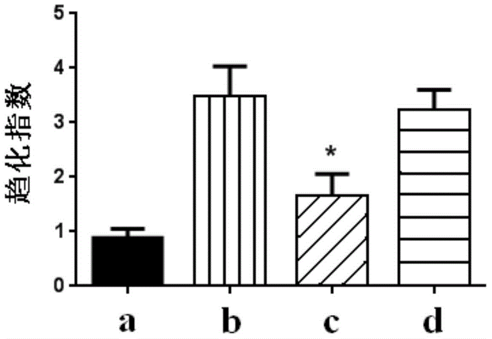 Anti-inflammatory application of small molecule compound AG-4