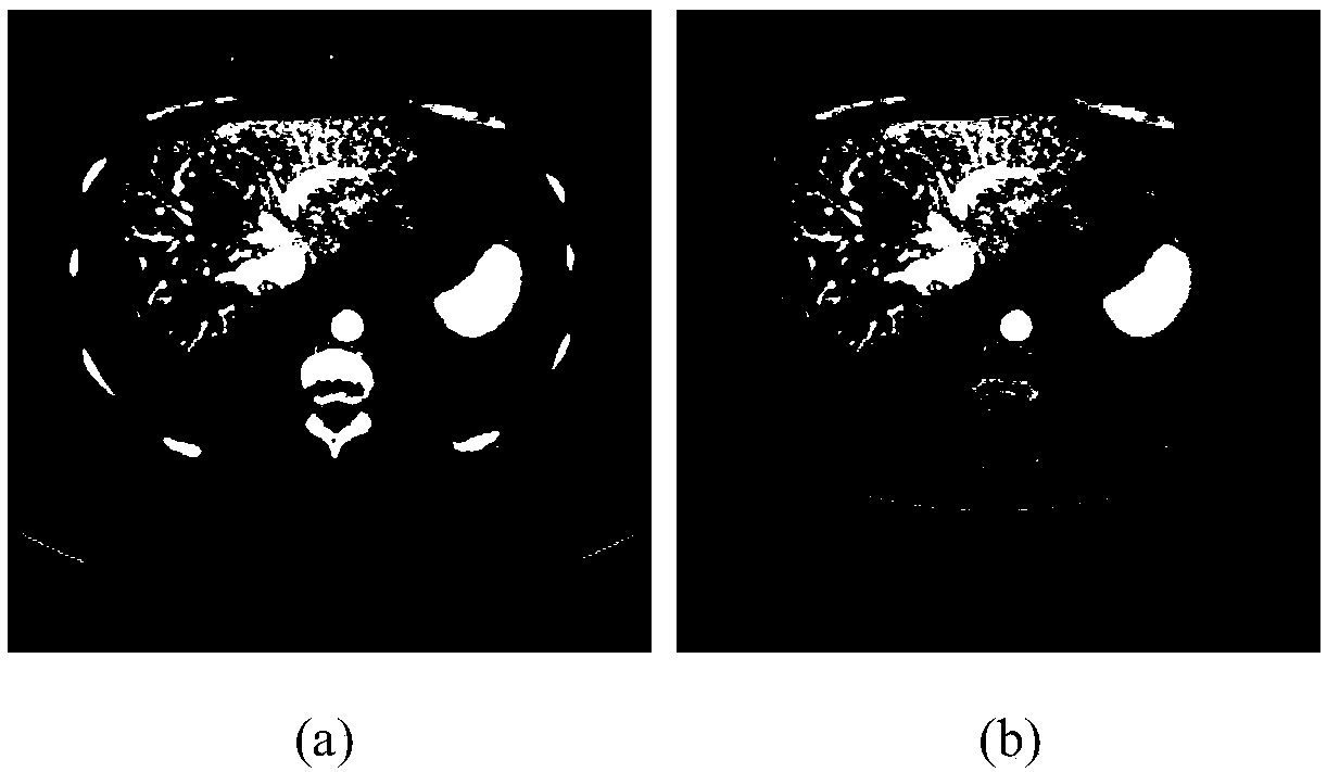 A liver automatic segmentation method of abdominal CT sequence images based on a level set and a shape descriptor