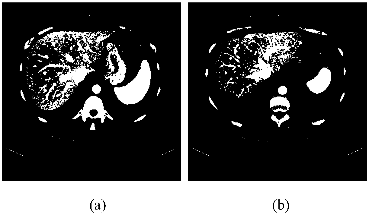 A liver automatic segmentation method of abdominal CT sequence images based on a level set and a shape descriptor