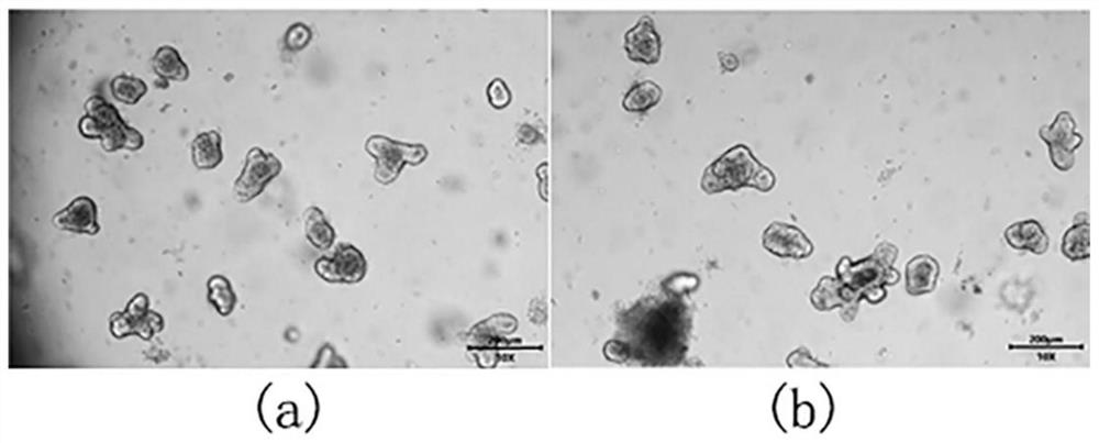 A kind of cryopreservation liquid and its preparation method and application