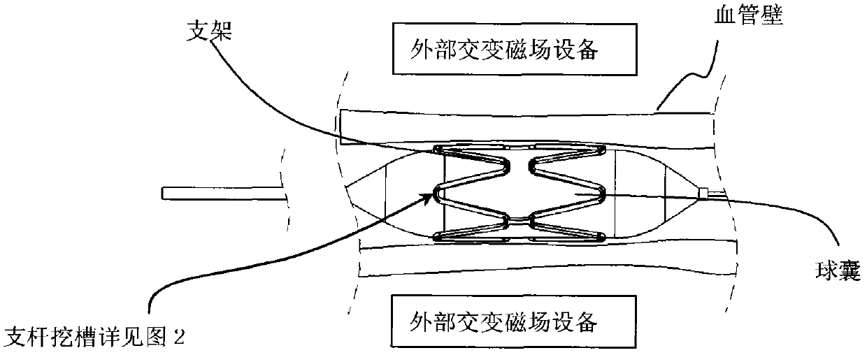 Biodegradable stent with groove and preparation method thereof