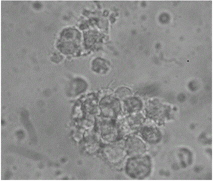 Brucella Omp16 protein antigen epitope polypeptides and application thereof