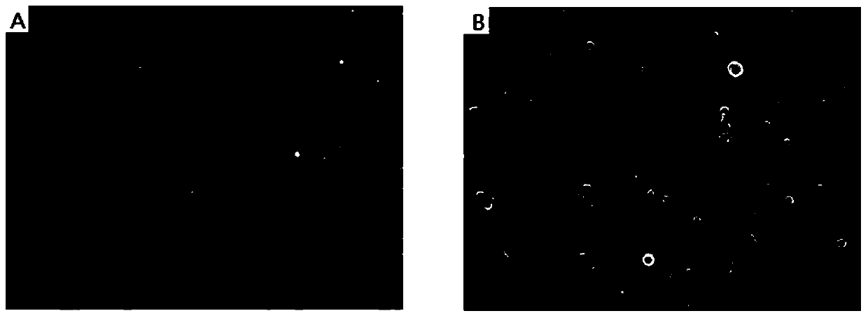 A method for isolating and culturing skin keratinocytes