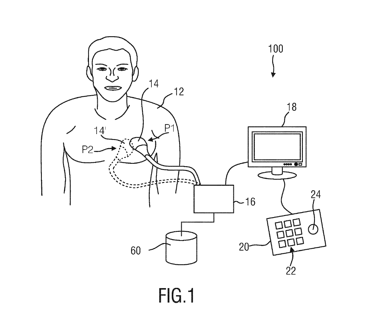 Ultrasound diagnosis apparatus