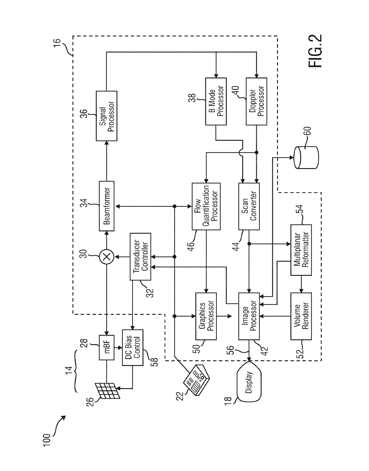 Ultrasound diagnosis apparatus