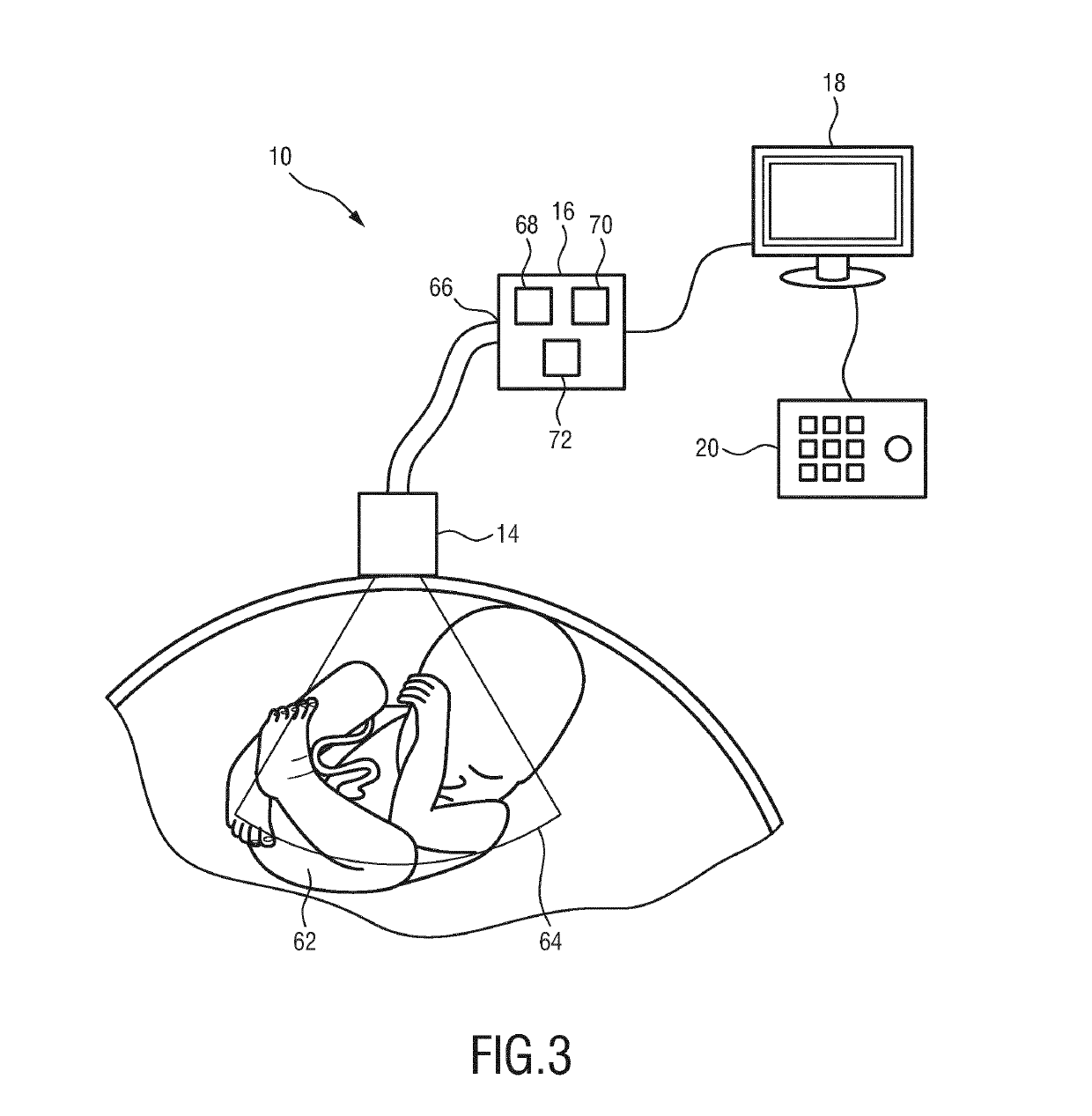 Ultrasound diagnosis apparatus