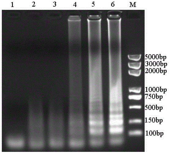 RT-LAMP (loop-mediated isothermal amplification) rapid detection kit for cucumber green mottle mosaic virus (CGMMV) and detection method