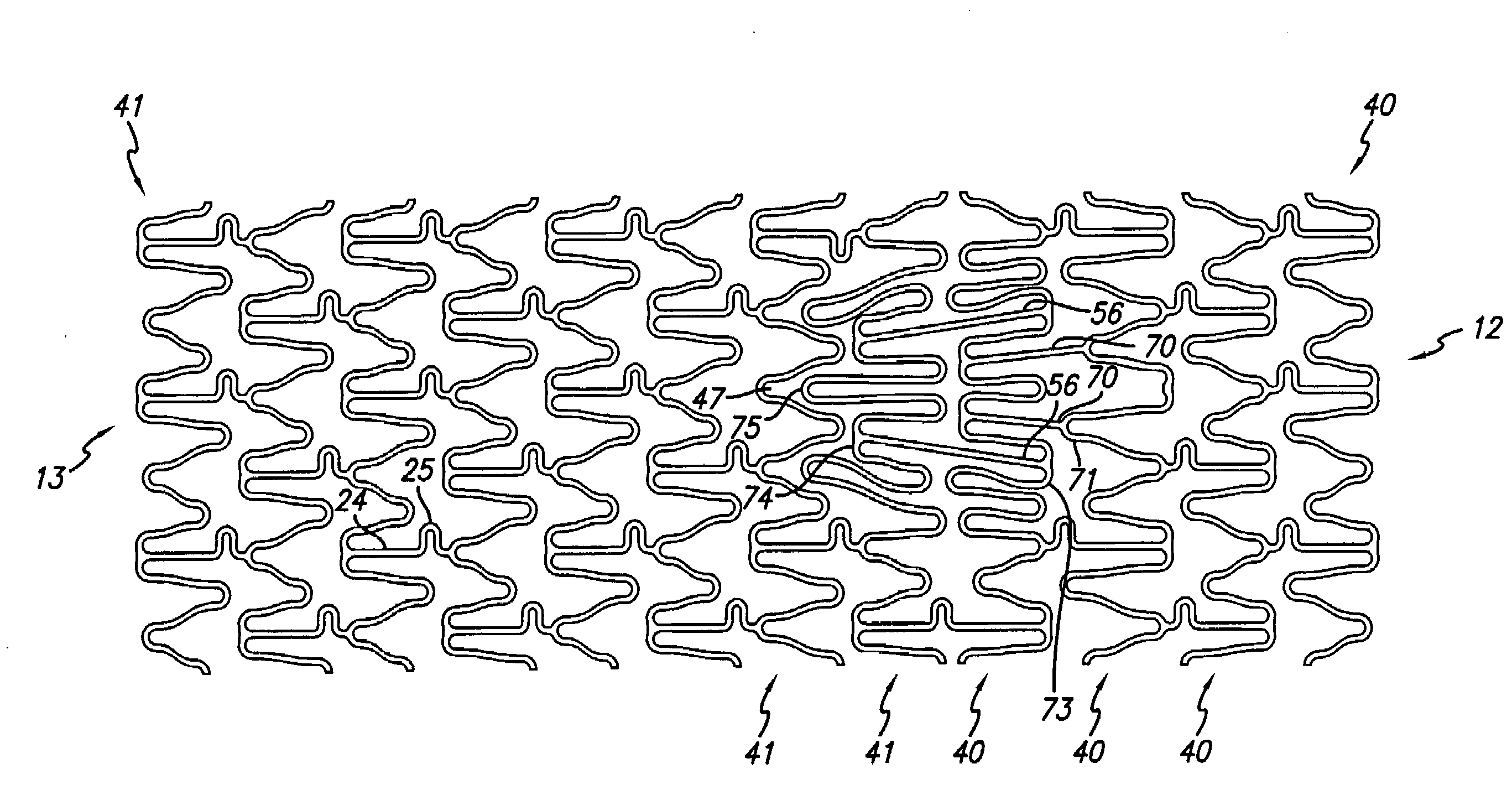 Stent and catheter assembly and method for treating bifurcations