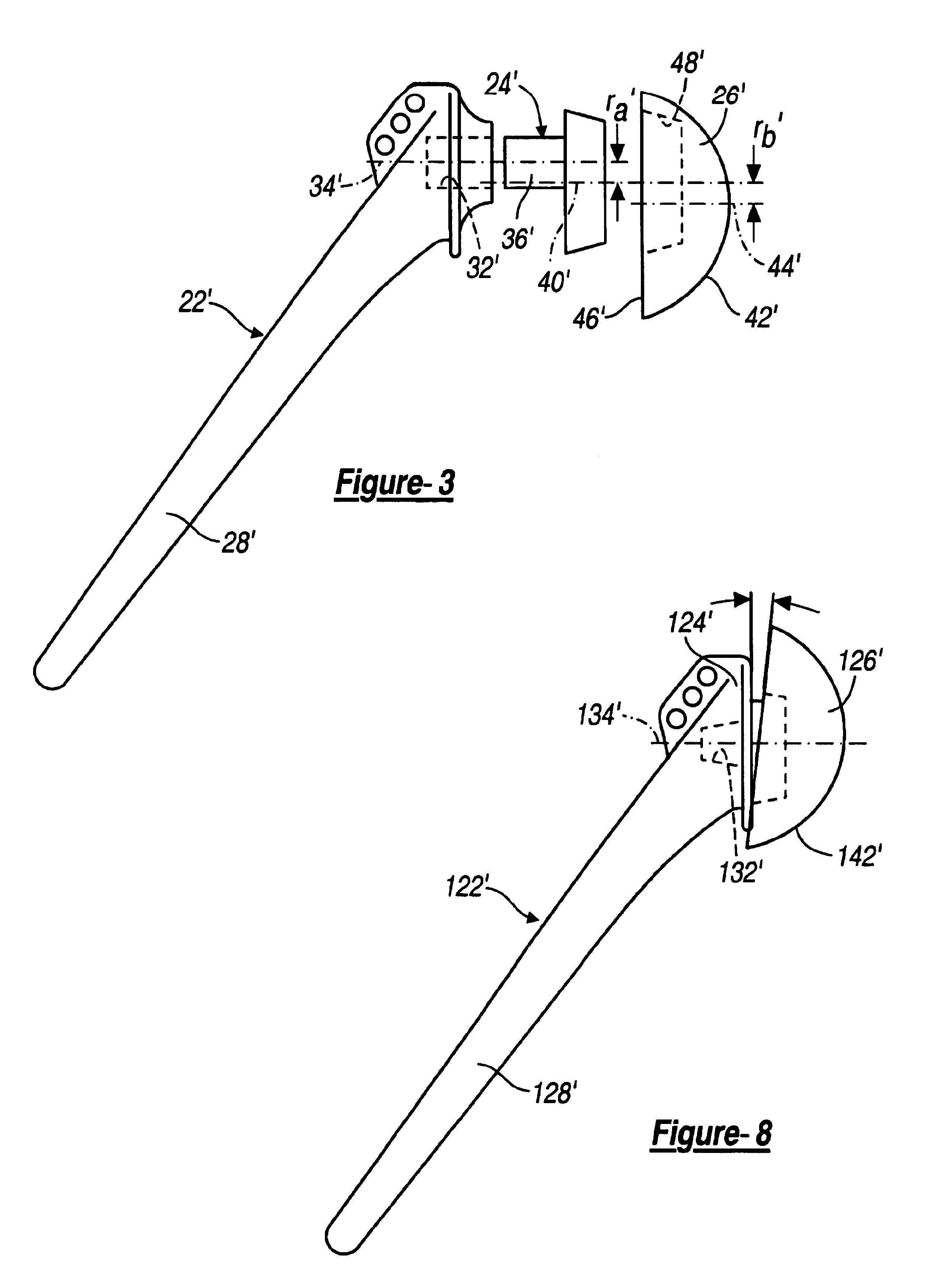 Shoulder prosthesis