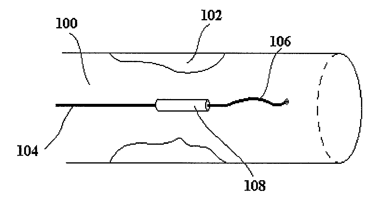 Device and method for minimizing restenosis after angioplasty treatment