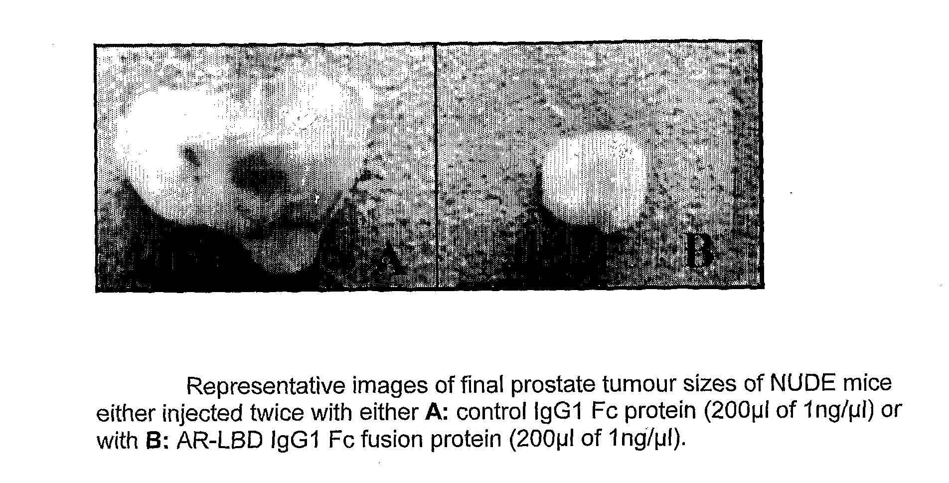 Use of estrogen and androgen binding proteins in methods and compositions for treating gynaecological cancers