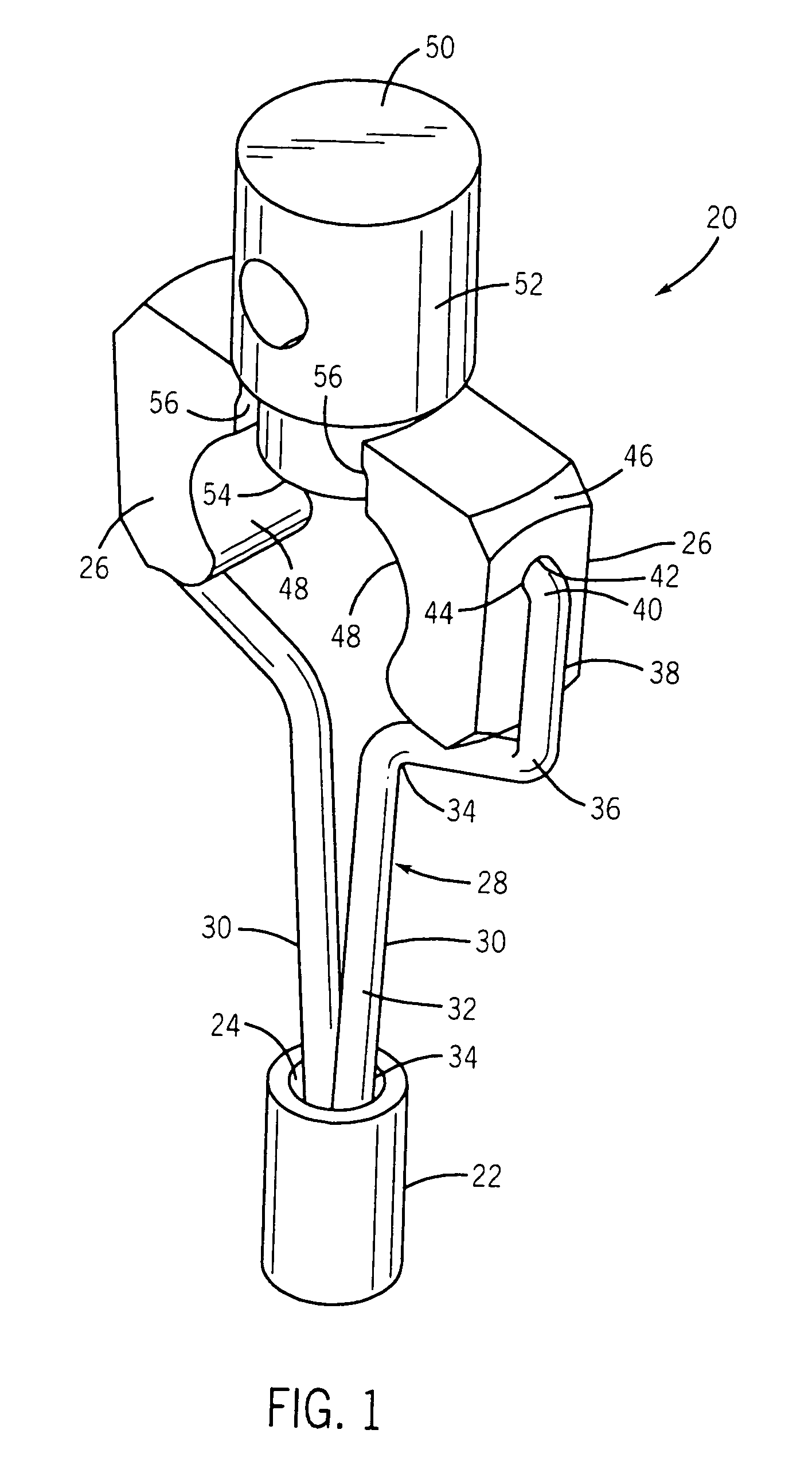 Attachment mechanism for middle ear prosthesis