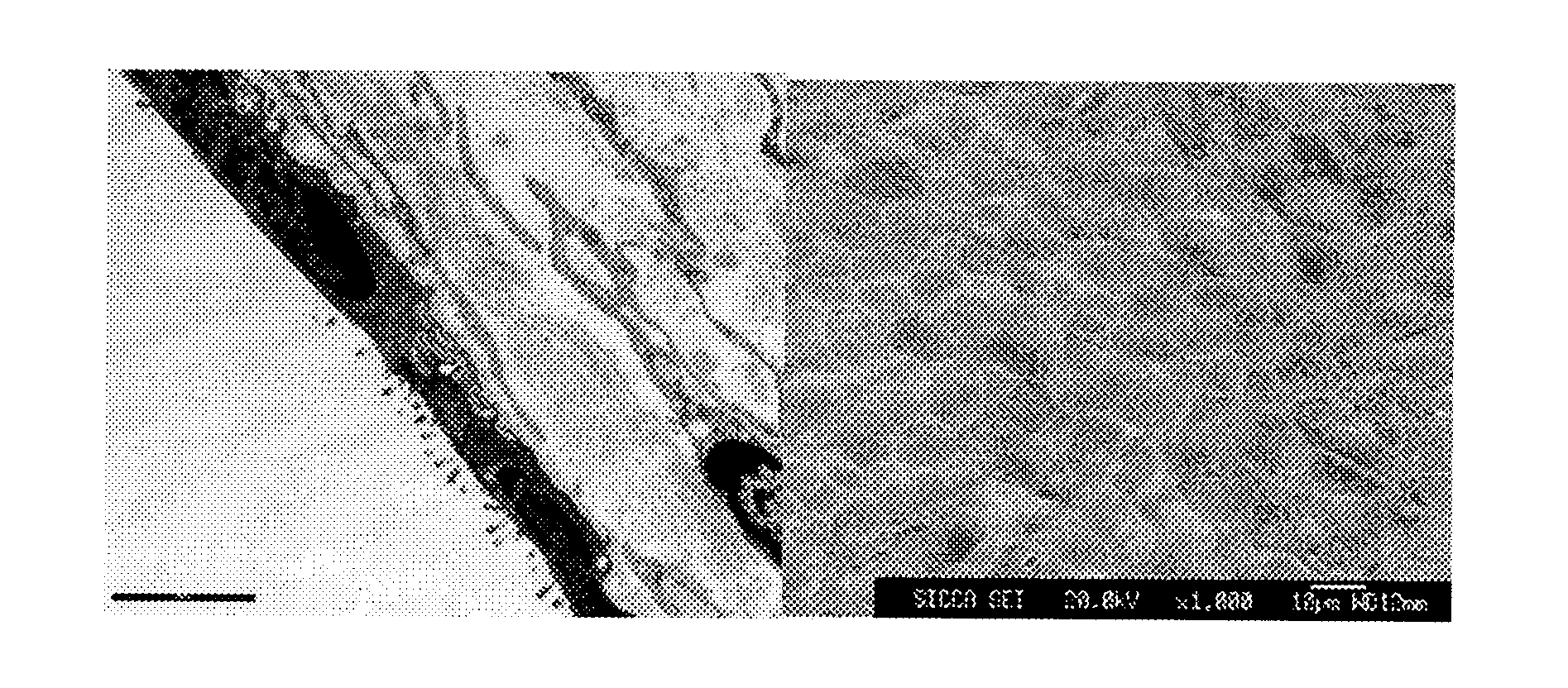 Method of treating hearing loss using xiap