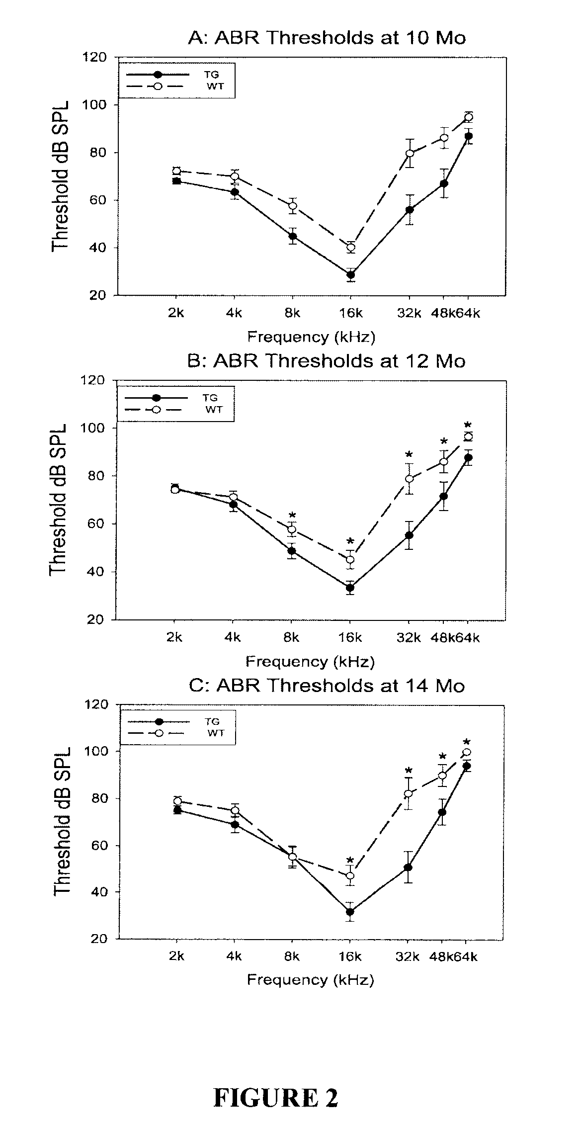 Method of treating hearing loss using xiap