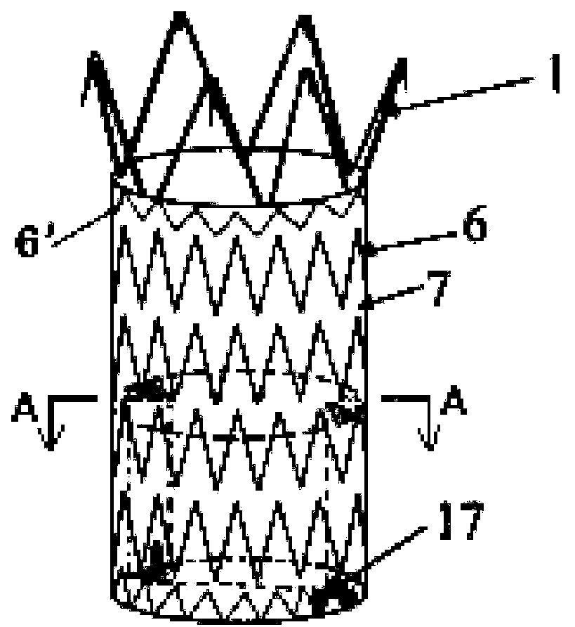 A combined abdominal aortic stent graft system and its application method