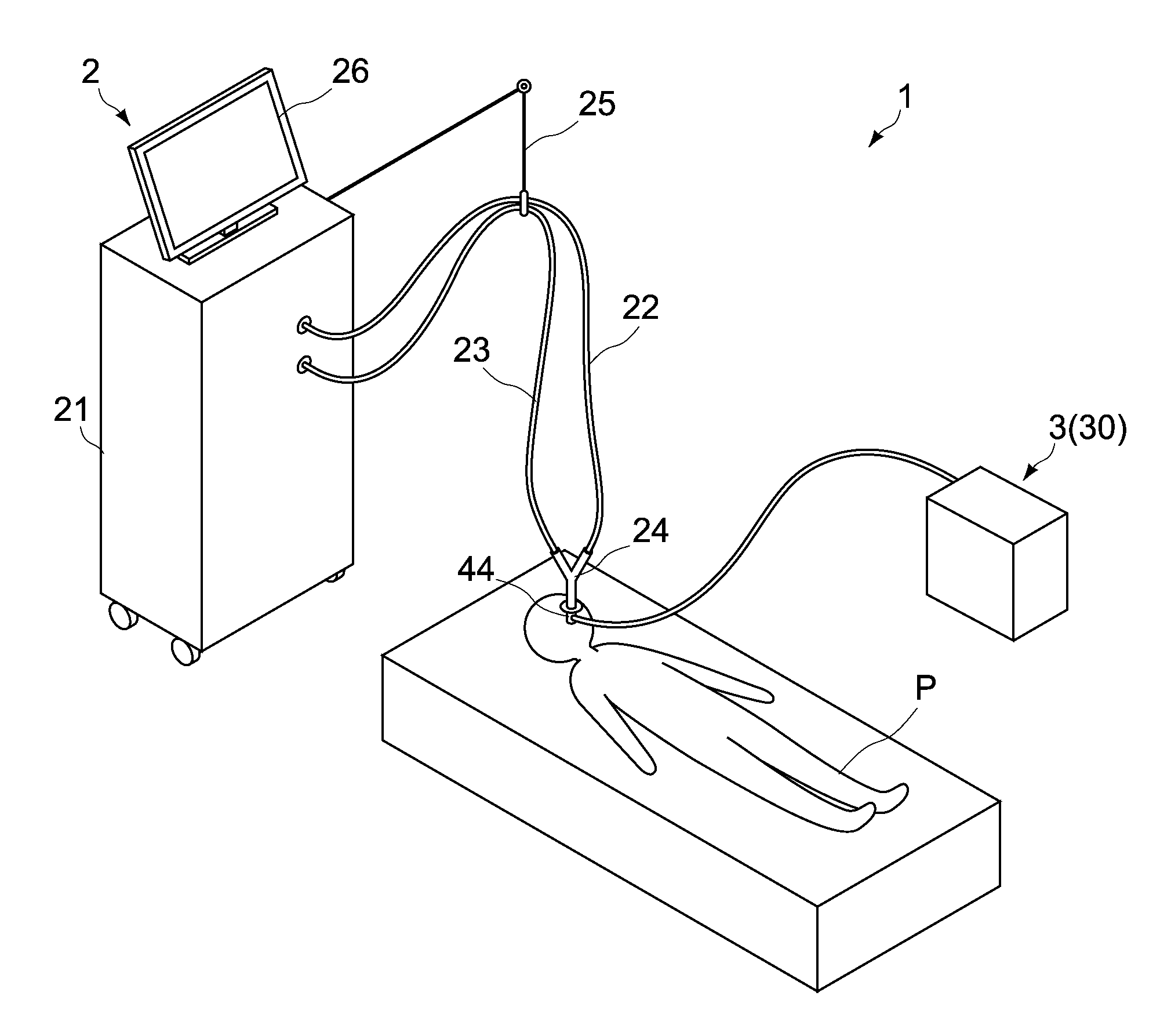 Sputum Apparatus, Artificial Ventilation System, and Method for Operating Sputum Apparatus