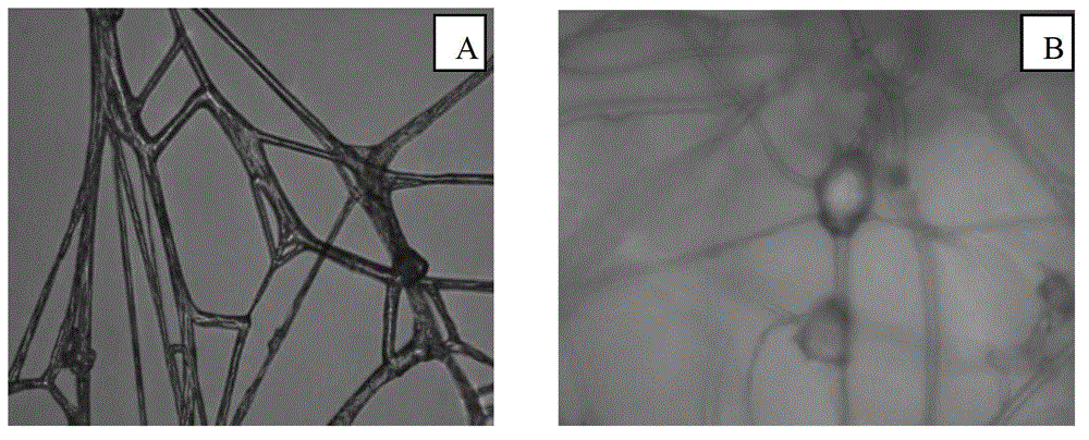 Apophysomycesspartina as well as acid-producing fermentation method and application thereof