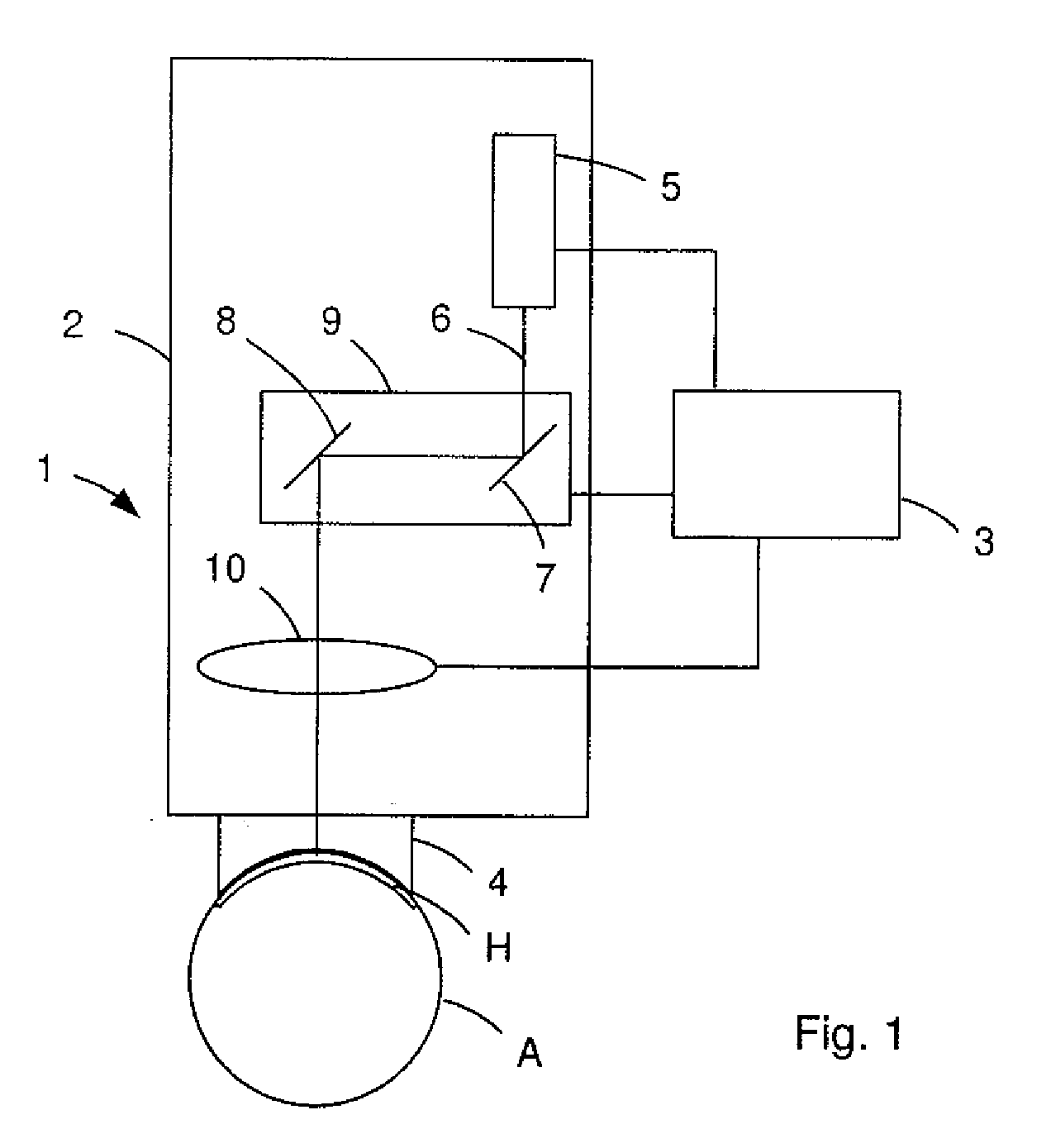 Apparatus and method for generating cut surfaces in the cornea of an eye for correction of ametropia