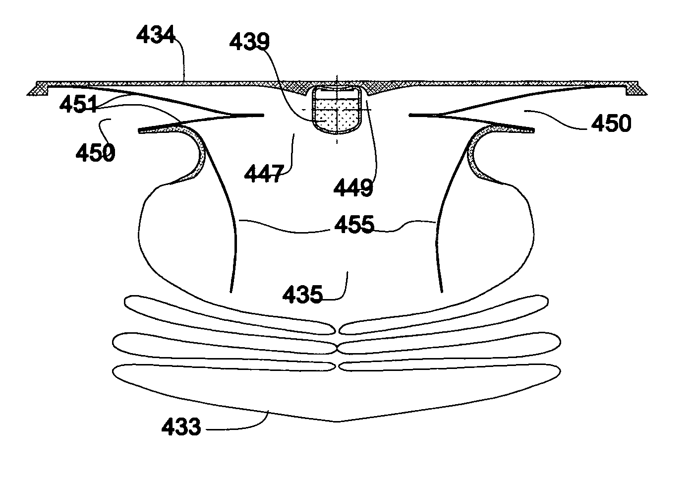 Inflator system