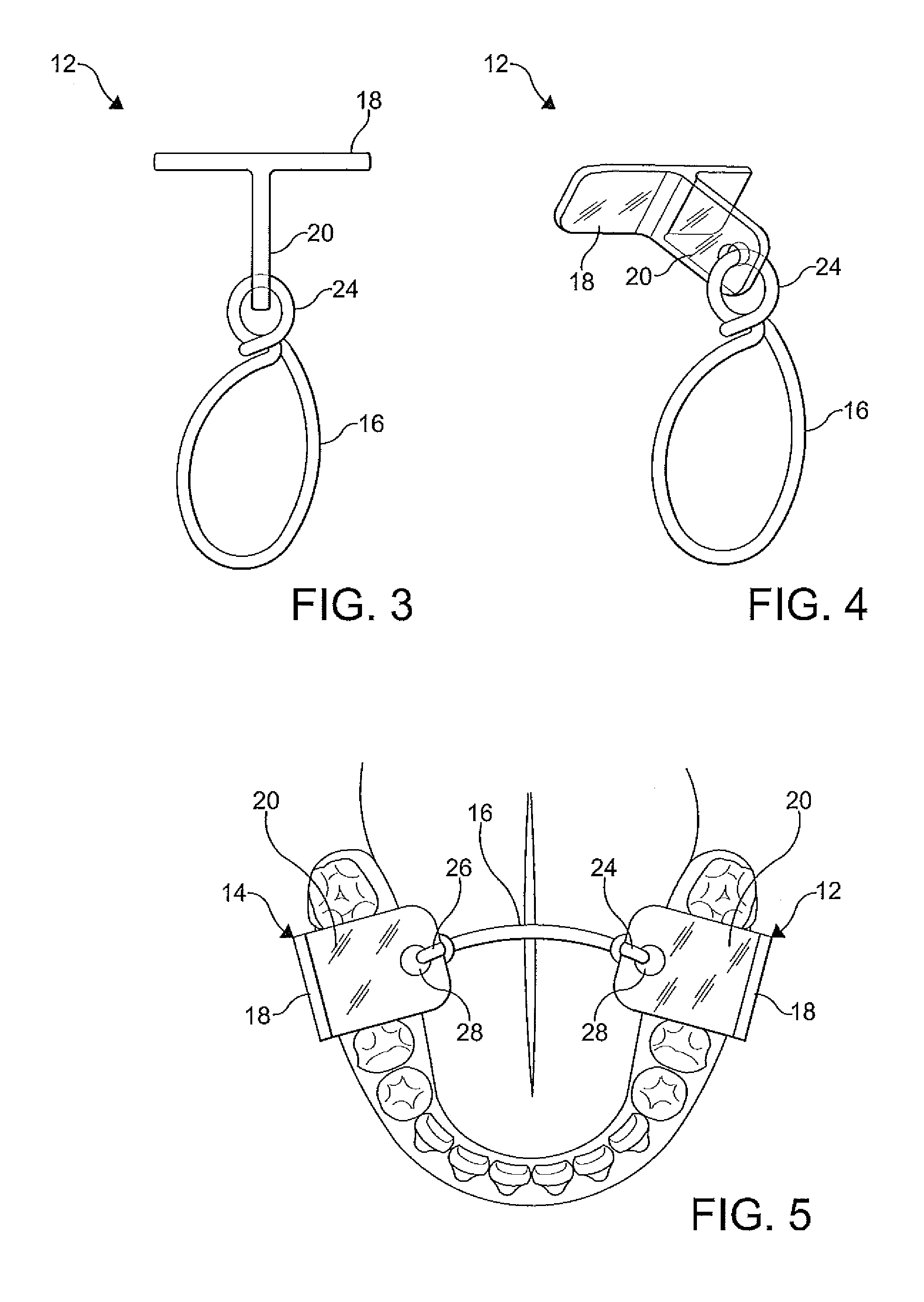 Speech therapy device