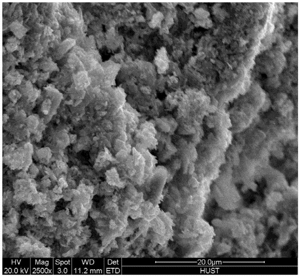 Brushite-calcium silicate/chitosan composite bone cement with rapid and controllable biodegrability