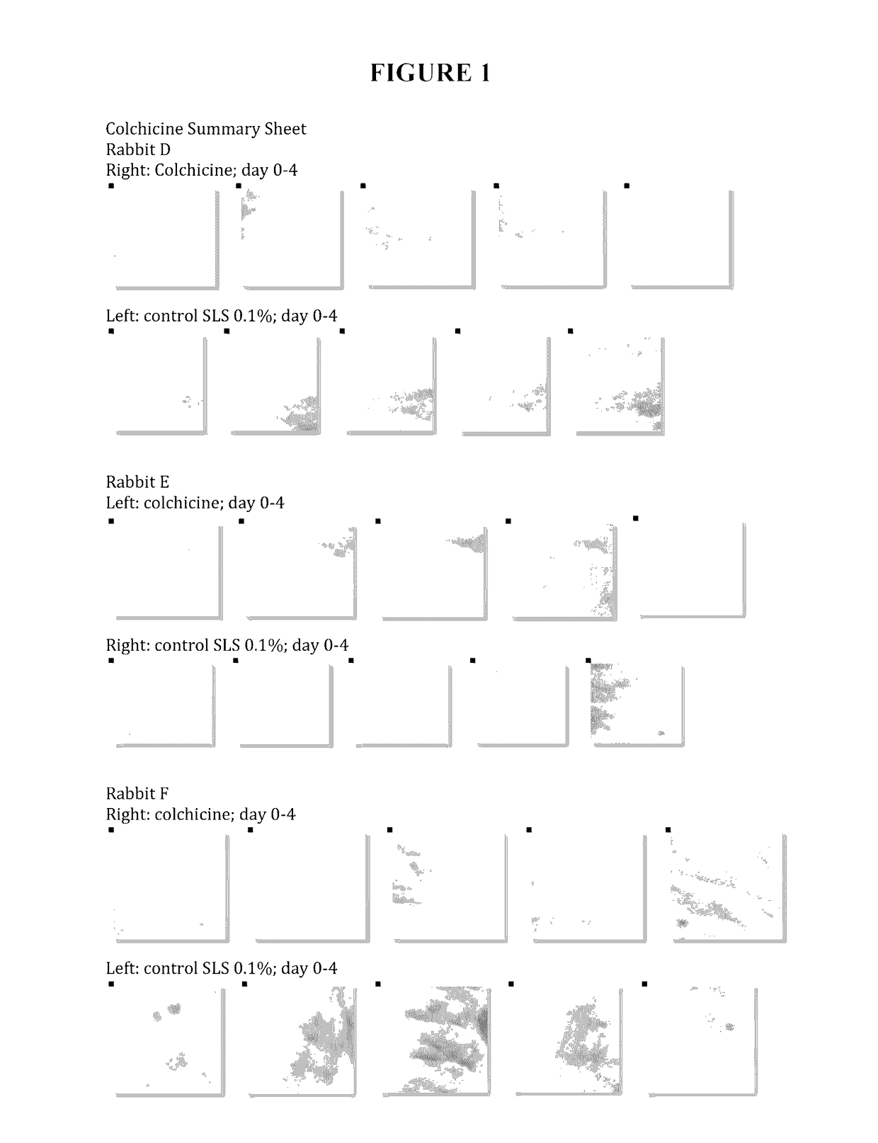 Homeopathic topical gel for transdermal delivery of colchicine formulations and method of use