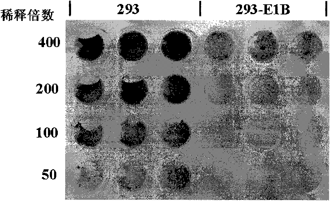 Replication defective recombinant adenovirus Ad41 vector system and application thereof