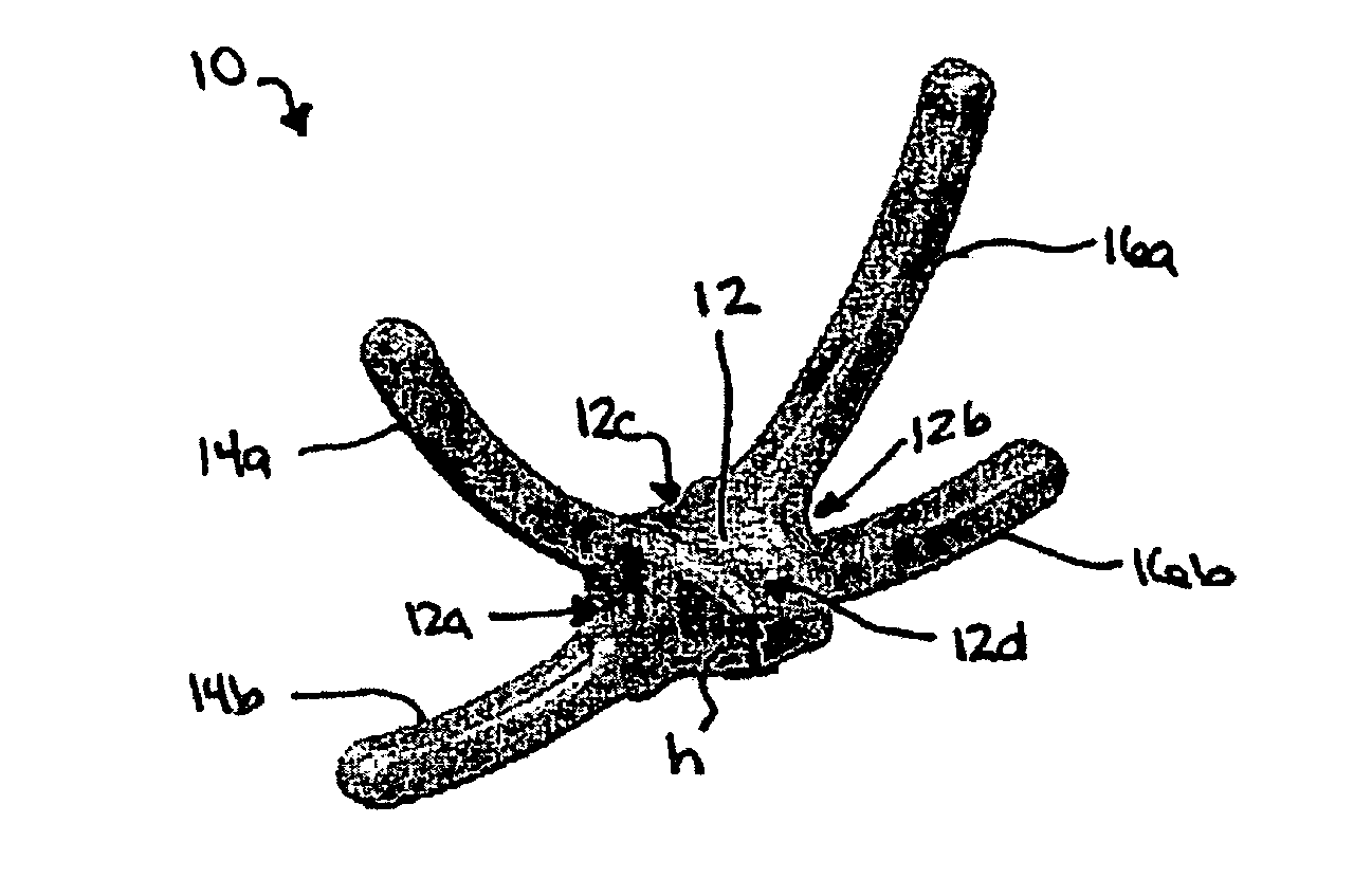 Posterior dynamic stabilization x-device