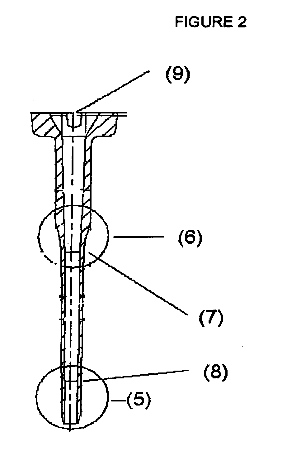 Injection moulding of a catheter