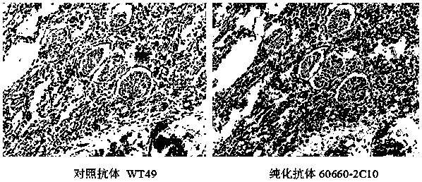 A monoclonal antibody secreting anti-wt1 protein and its application